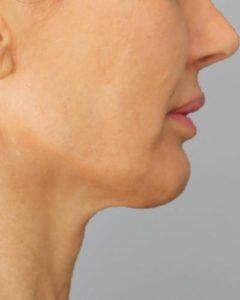 prof7-240x300