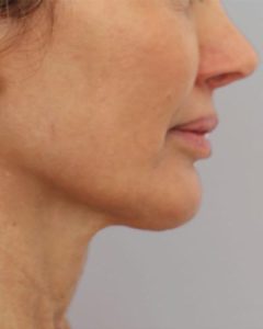 prof8-240x300