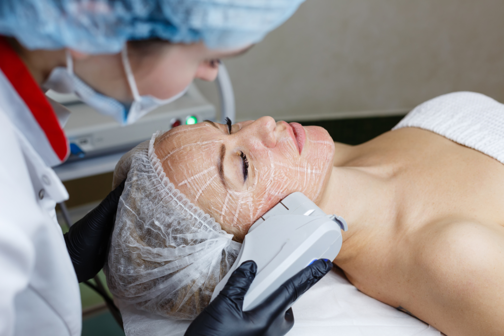 Ultherapy 11 1024x683 1