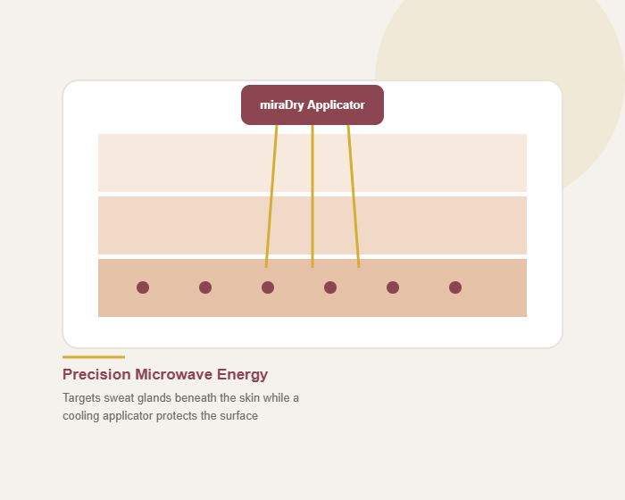 miradry treatment illustration